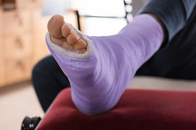 Foot and ankle fractures treatment in the Miami-Dade County, FL: Miami (Hialeah, Miami Gardens, Miami Beach, Kendall, Doral, North Miami, Fontainebleau, Tamiami, Westchester, Coral Gables, Hialeah Gardens, Sweetwater, Gladeview) areas