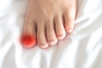 How Did I Get an Ingrown Toenail?